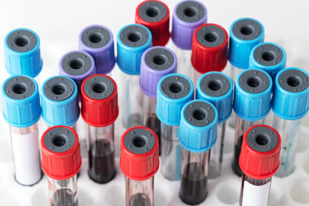Testing and Patient Care Events