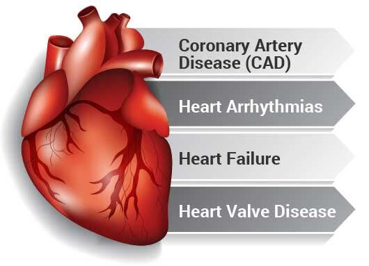 heart disease feb 2021 heart.jpg